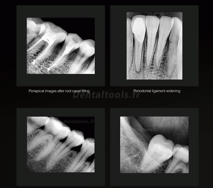 Runyes DR730 Capteur de rayons X numérique dentaire capteur intra-oral dentaire